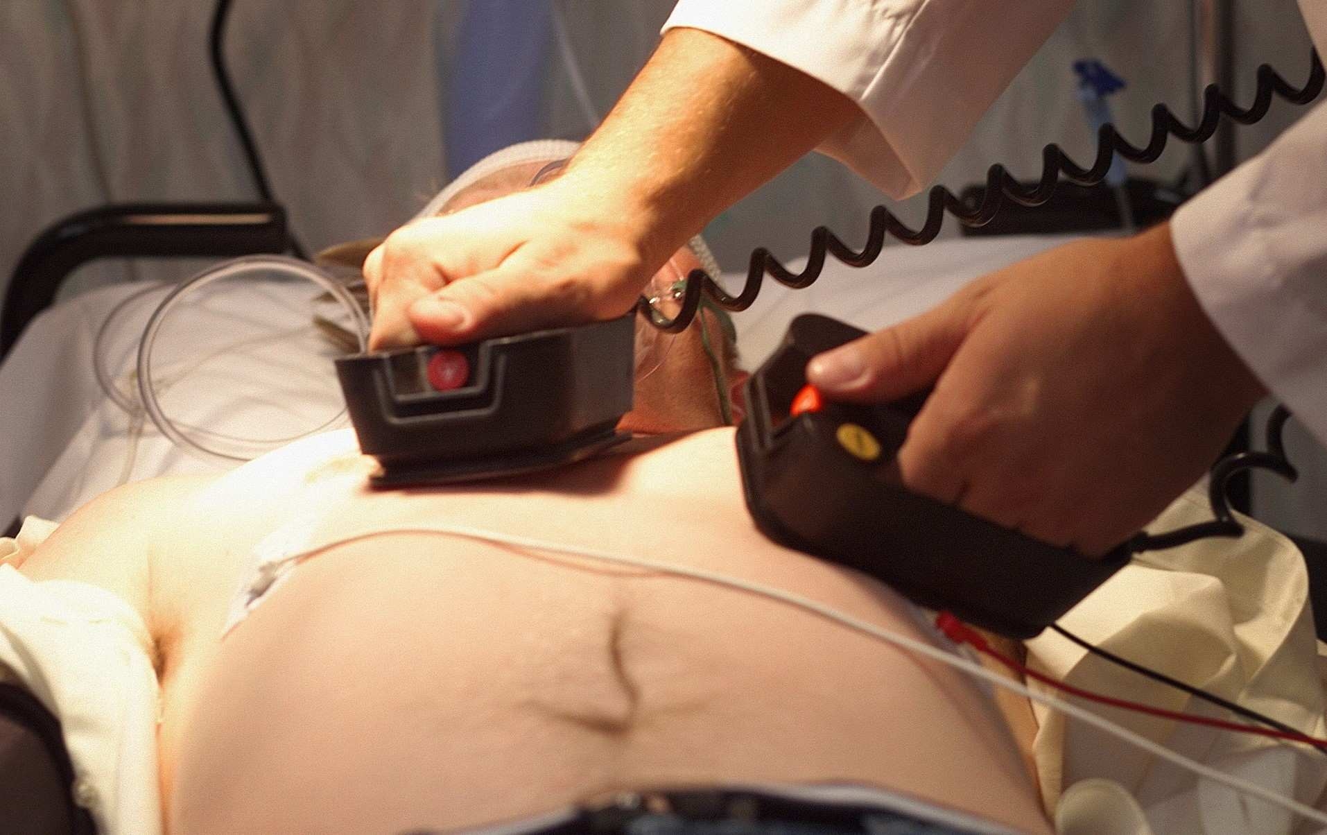 «Ростех» зарегистрировал аппарат для спасения пациентов с остановкой сердца и дыхания
